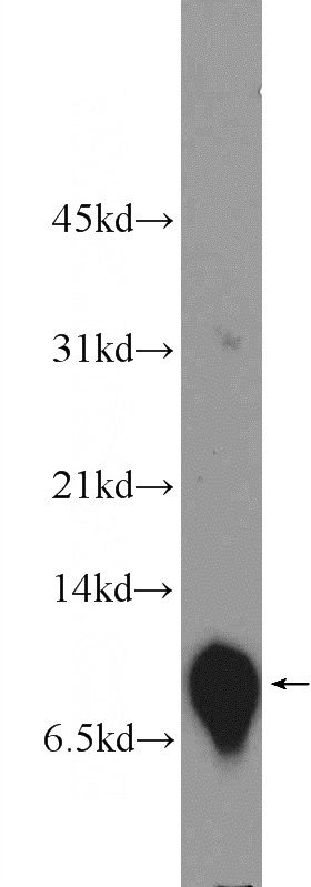 mouse brain tissue were subjected to SDS PAGE followed by western blot with Catalog No:113749(PCP4 Antibody) at dilution of 1:300