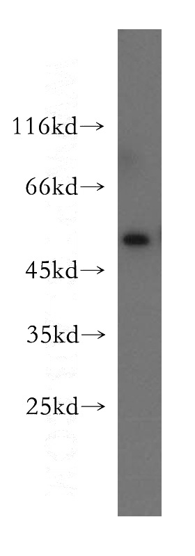 human placenta tissue were subjected to SDS PAGE followed by western blot with Catalog No:113672(PD-ECGF antibody) at dilution of 1:300