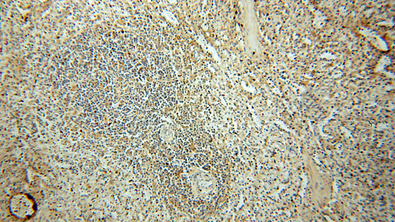 Immunohistochemical of paraffin-embedded human spleen using Catalog No:116365(TSPAN7 antibody) at dilution of 1:50 (under 10x lens)