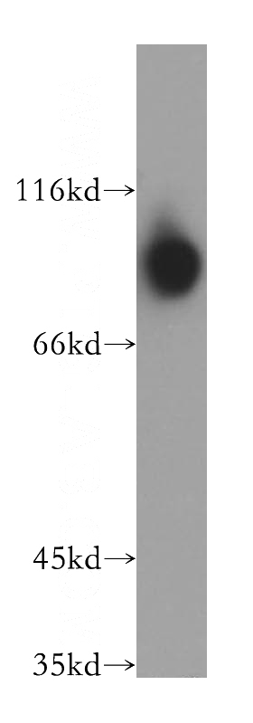 human placenta tissue were subjected to SDS PAGE followed by western blot with Catalog No:109941(DIDO1 antibody) at dilution of 1:800