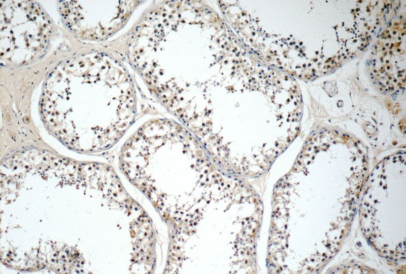 Immunohistochemistry of paraffin-embedded human testis tissue slide using Catalog No:109003(CCL27 Antibody) at dilution of 1:50 (under 10x lens)