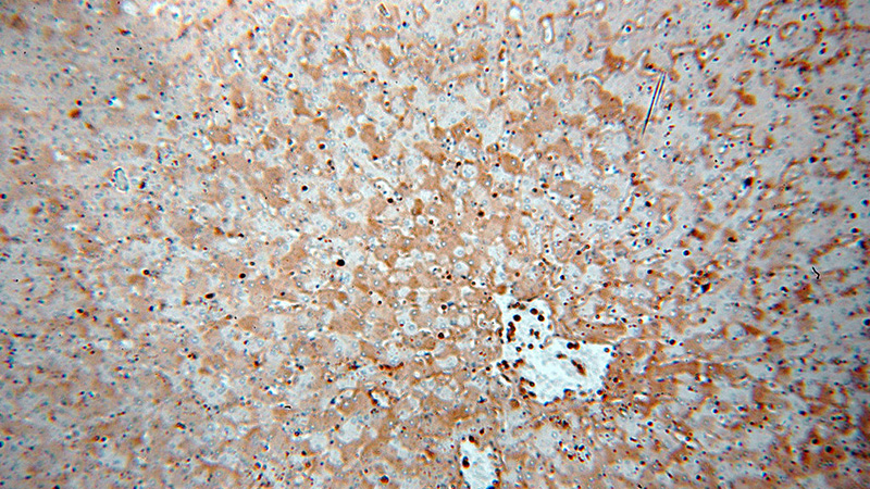 Immunohistochemical of paraffin-embedded human liver using Catalog No:112002(KIF18A antibody) at dilution of 1:100 (under 10x lens)