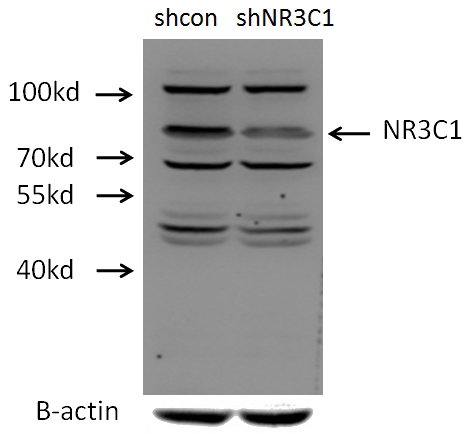 C2C12 cells (shcontrol and shRNA of NR3C1) were subjected to SDS PAGE followed by western blot with Catalog No:111041(NR3C1 antibody) at dilution of 1:1000. (Data provided by Angran Biotech (www.miRNAlab.com)).