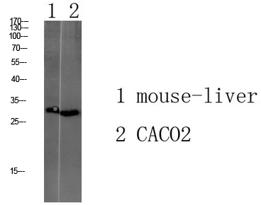 Fig1:; Western blot analysis of various lysate, antibody was diluted at 1000. Secondary antibody（catalog#: HA1001) was diluted at 1:20000