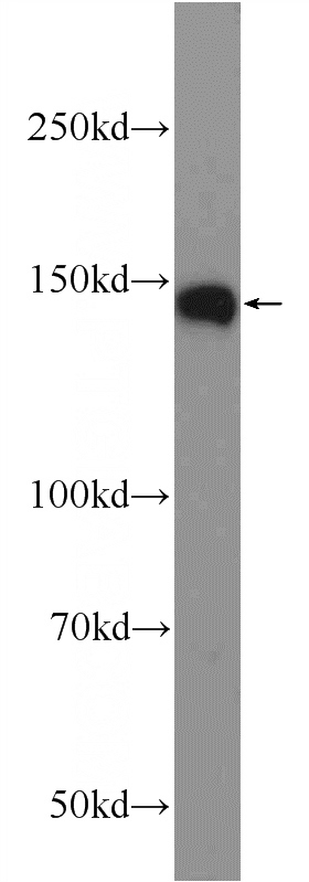rat brain tissue were subjected to SDS PAGE followed by western blot with Catalog No:116815(WDR7 Antibody) at dilution of 1:1000