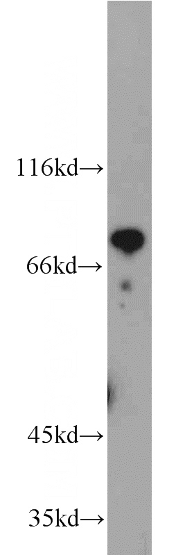 Jurkat cells were subjected to SDS PAGE followed by western blot with Catalog No:111274(HBS1L antibody) at dilution of 1:2000