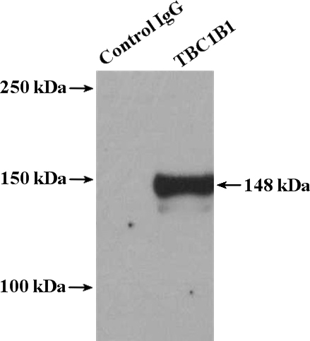 IP Result of anti-TBC1D1 (IP:Catalog No:115861, 4ug; Detection:Catalog No:115861 1:1000) with Jurkat cells lysate 2400ug.