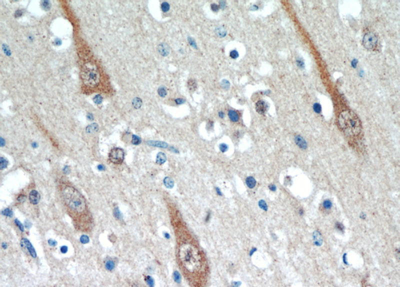 Immunohistochemical of paraffin-embedded human brain using Catalog No:116091(TMEM106B antibody) at dilution of 1:100 (under 40x lens)