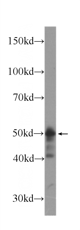 HeLa cells were subjected to SDS PAGE followed by western blot with Catalog No:107154(CHK1 Antibody) at dilution of 1:1000