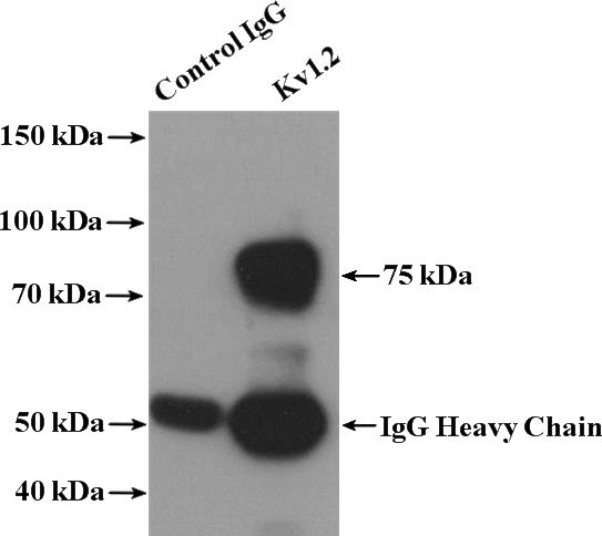 IP Result of anti-KCNA2 (IP:Catalog No:112255, 4ug; Detection:Catalog No:112255 1:500) with HeLa cells lysate 5200ug.
