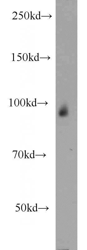 human placenta tissue were subjected to SDS PAGE followed by western blot with Catalog No:109218(CHD2 antibody) at dilution of 1:500
