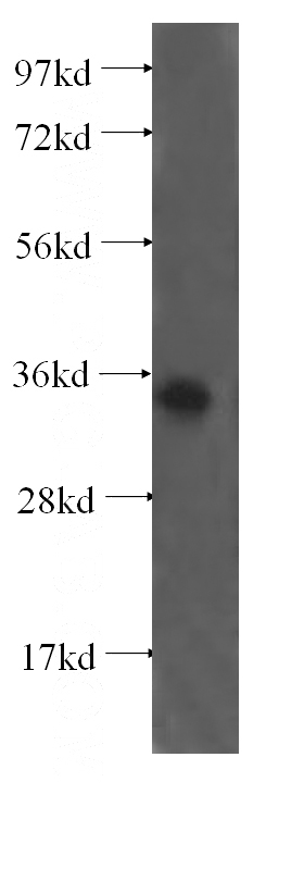 human testis tissue were subjected to SDS PAGE followed by western blot with Catalog No:114761(RNF41 antibody) at dilution of 1:500