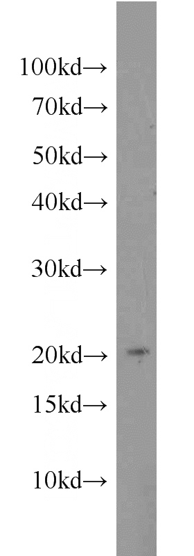 HEK-293 cells were subjected to SDS PAGE followed by western blot with Catalog No:112663(MIXL1 antibody) at dilution of 1:1000