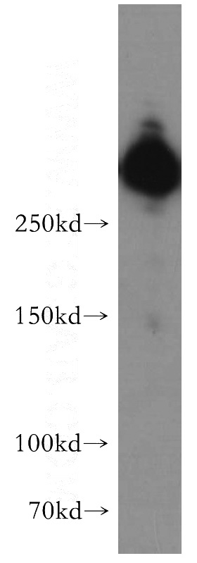 HepG2 cells were subjected to SDS PAGE followed by western blot with Catalog No:111682(IGF2R-Specific antibody) at dilution of 1:500