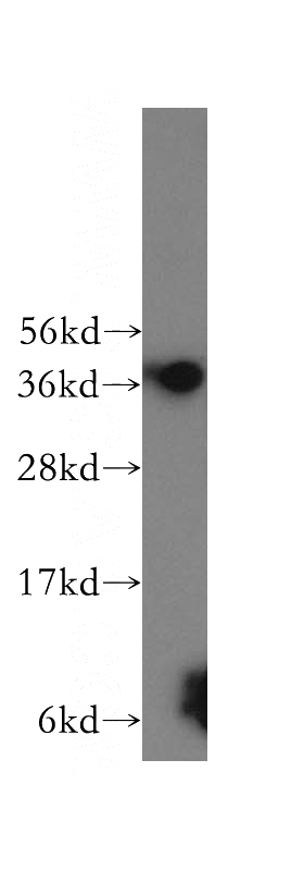 Jurkat cells were subjected to SDS PAGE followed by western blot with Catalog No:112778(MTHFD2 antibody) at dilution of 1:300