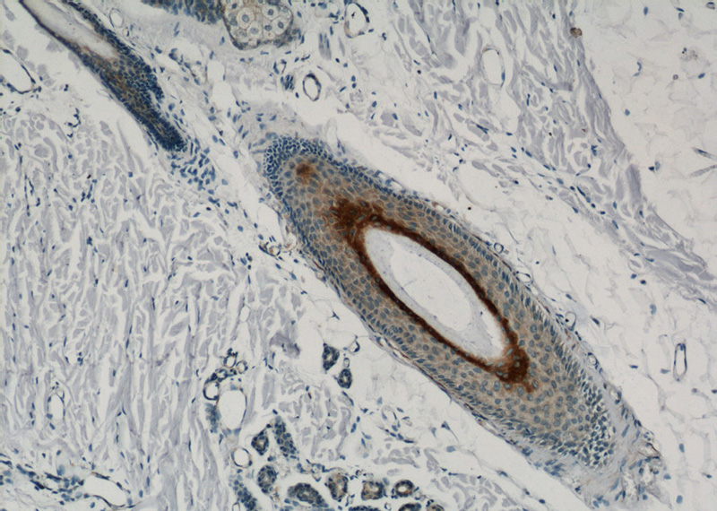 Immunohistochemistry of paraffin-embedded human skin tissue slide using Catalog No:111813(Involucrin Antibody) at dilution of 1:50 (under 10x lens)