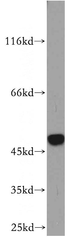 mouse skeletal muscle tissue were subjected to SDS PAGE followed by western blot with Catalog No:115407(SMYD2 antibody) at dilution of 1:500