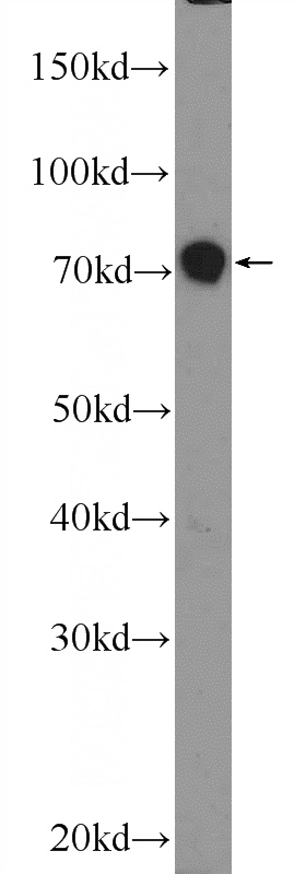 HEK-293 cells were subjected to SDS PAGE followed by western blot with Catalog No:111896(JPH1 Antibody) at dilution of 1:2000