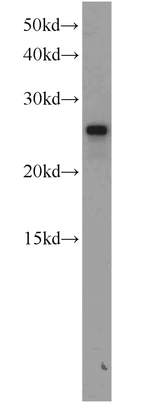mouse liver tissue were subjected to SDS PAGE followed by western blot with Catalog No:115066(SAR1B antibody) at dilution of 1:500