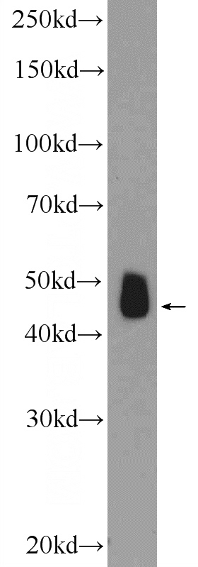 mouse brain tissue were subjected to SDS PAGE followed by western blot with Catalog No:115270(SHD Antibody) at dilution of 1:600