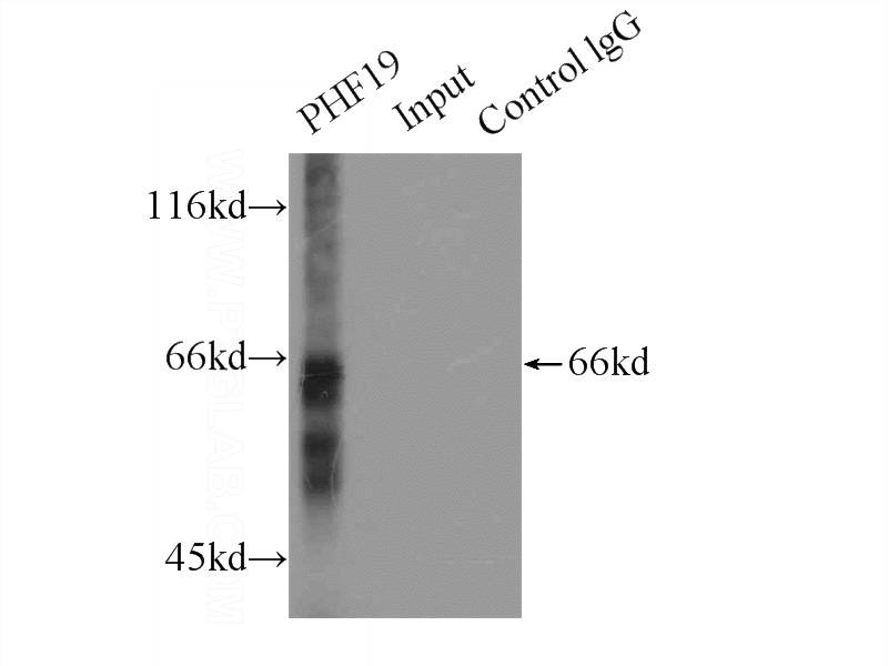 IP Result of anti-PHF19 (IP:Catalog No:113810, 4ug; Detection:Catalog No:113810 1:500) with HeLa cells lysate 2000ug.