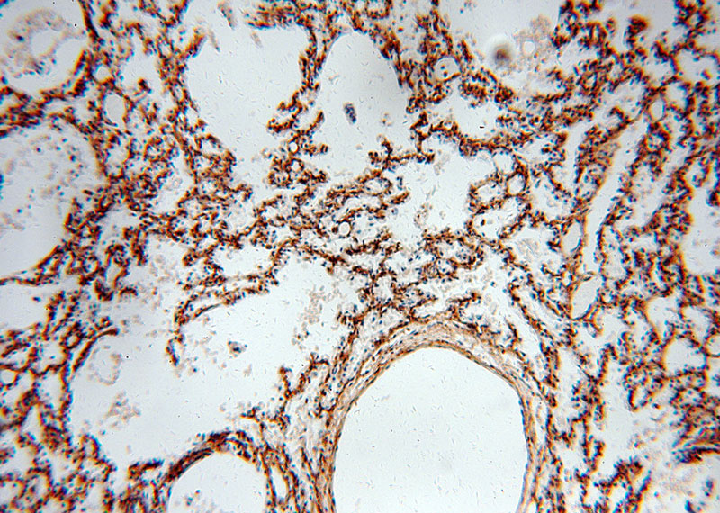 Immunohistochemical of paraffin-embedded human lung using Catalog No:113900(PIH1D1 antibody) at dilution of 1:100 (under 10x lens)