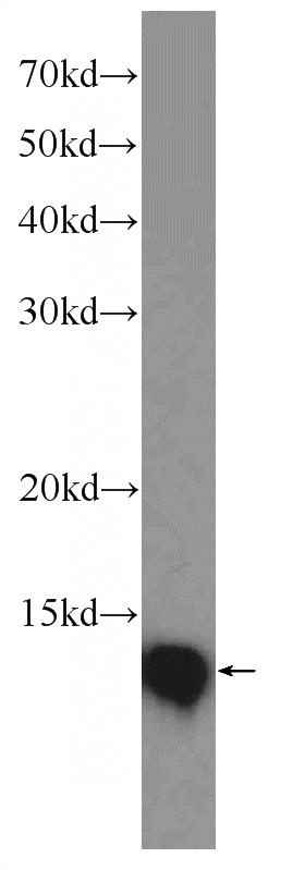 Jurkat cells were subjected to SDS PAGE followed by western blot with Catalog No:116044(TXN Antibody) at dilution of 1:2000