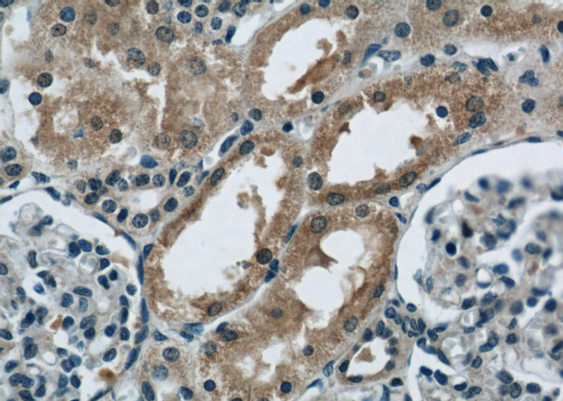 Immunohistochemical of paraffin-embedded human kidney using Catalog No:108950(CBY1 antibody) at dilution of 1:50 (under 40x lens)