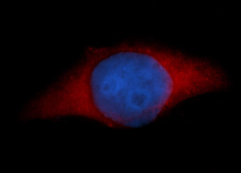 Immunofluorescent analysis of Hela cells, using TXN antibody Catalog No:116044 at 1:50 dilution and Rhodamine-labeled goat anti-rabbit IgG (red). Blue pseudocolor = DAPI (fluorescent DNA dye).