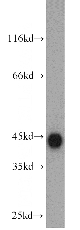mouse liver tissue were subjected to SDS PAGE followed by western blot with Catalog No:110858(CSE antibody) at dilution of 1:1000