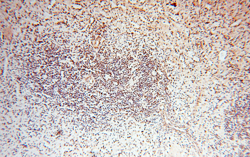Immunohistochemical of paraffin-embedded human spleen using Catalog No:116128(TIMELESS antibody) at dilution of 1:50 (under 10x lens)