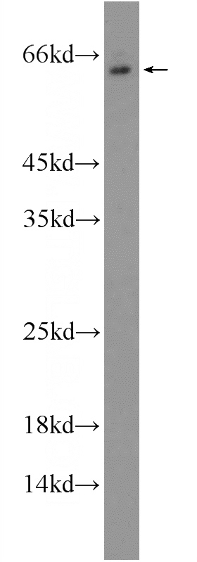 NIH/3T3 cells were subjected to SDS PAGE followed by western blot with Catalog No:112665(MKK7 Antibody) at dilution of 1:300