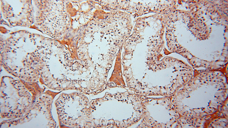 Immunohistochemical of paraffin-embedded human testis using Catalog No:108309(ATP6V1C2 antibody) at dilution of 1:50 (under 10x lens)