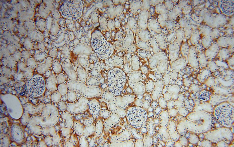 Immunohistochemical of paraffin-embedded human kidney using Catalog No:109438(COL6A1 antibody) at dilution of 1:100 (under 10x lens)