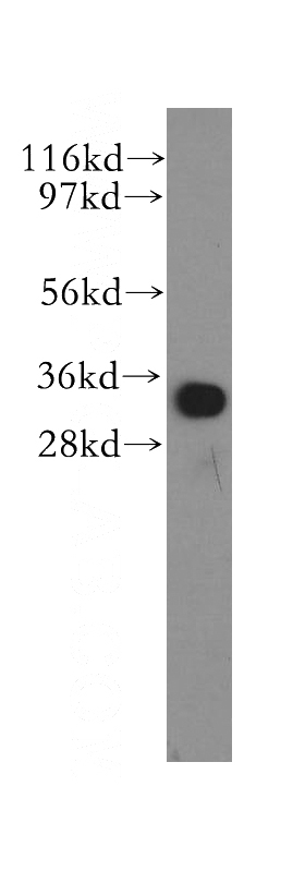 human liver tissue were subjected to SDS PAGE followed by western blot with Catalog No:112714(MND1 antibody) at dilution of 1:500