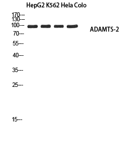 Fig1:; Western blot analysis of HepG2 K562 Hela Colo using ADAMTS-2 antibody.. Secondary antibody（catalog#: HA1001) was diluted at 1:20000
