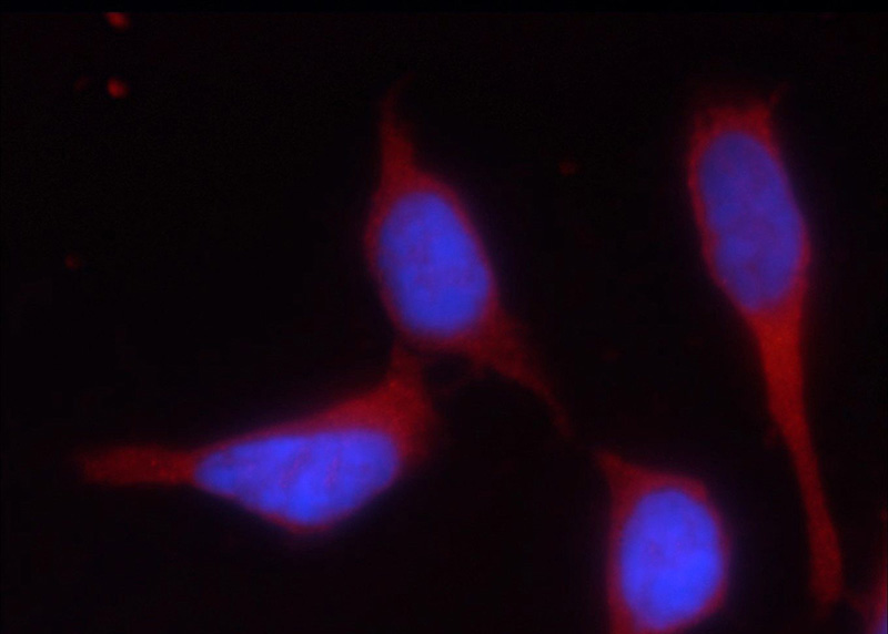 Immunofluorescent analysis of HEK-293 cells using Catalog No:111392(HEATR2 Antibody) at dilution of 1:25 and Rhodamine-Goat anti-Rabbit IgG