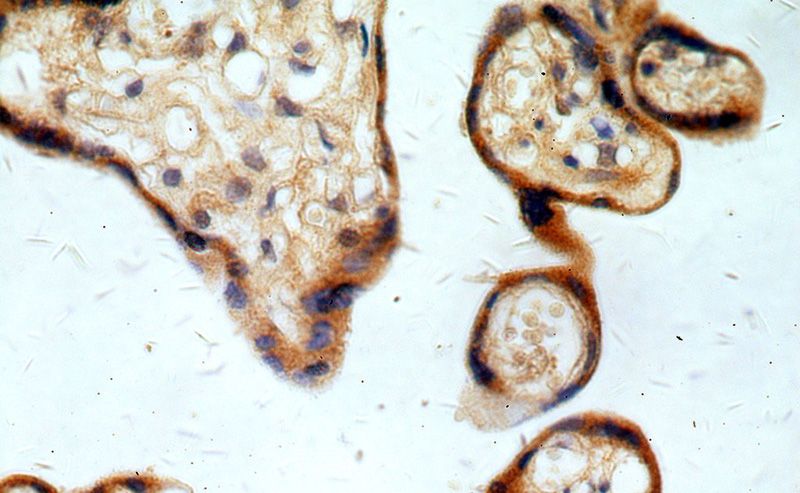 Immunohistochemical of paraffin-embedded human placenta using Catalog No:114621(REX2 antibody) at dilution of 1:50 (under 40x lens)