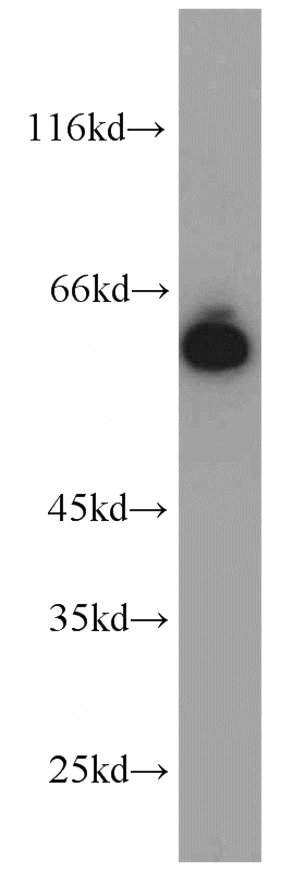 HeLa cells were subjected to SDS PAGE followed by western blot with Catalog No:111048(GORASP2 antibody) at dilution of 1:1000