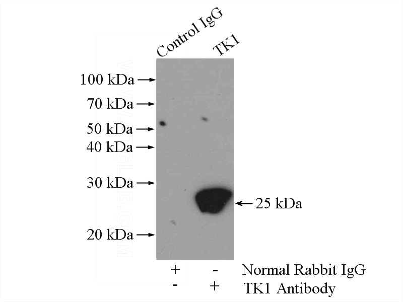 IP Result of anti-TK1 (IP:Catalog No:116067, 4ug; Detection:Catalog No:116067 1:300) with HEK-293 cells lysate 2000ug.
