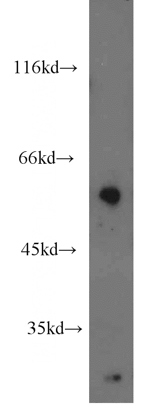 HL-60 cells were subjected to SDS PAGE followed by western blot with Catalog No:110324(ENPP4 antibody) at dilution of 1:1200