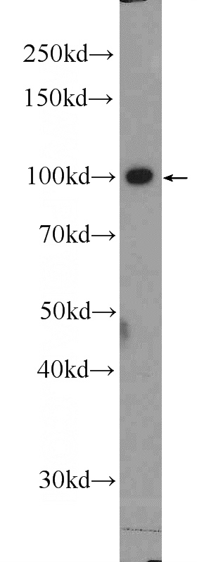 K-562 cells were subjected to SDS PAGE followed by western blot with Catalog No:108898(CBL Antibody) at dilution of 1:1000