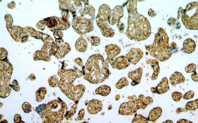 Immunohistochemical of paraffin-embedded human placenta using Catalog No:116882(YBX1 antibody) at dilution of 1:100 (under 10x lens)
