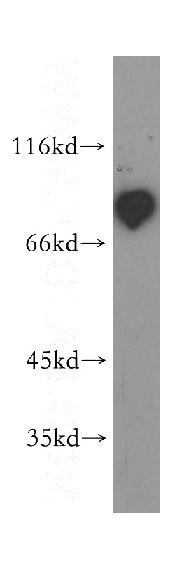 MDA-MB-453s cells were subjected to SDS PAGE followed by western blot with Catalog No:112199(LEPREL2 antibody) at dilution of 1:400