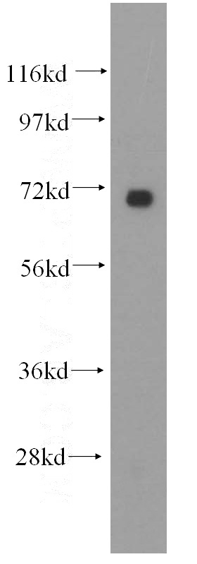 mouse thymus tissue were subjected to SDS PAGE followed by western blot with Catalog No:115085(SEC61A1 antibody) at dilution of 1:200