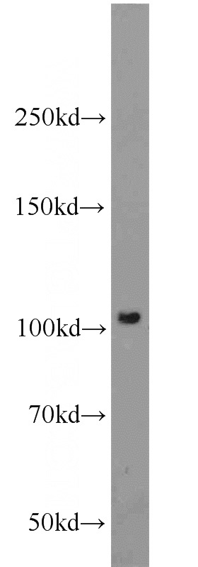 Jurkat cells were subjected to SDS PAGE followed by western blot with Catalog No:113290(NOD2 antibody) at dilution of 1:800