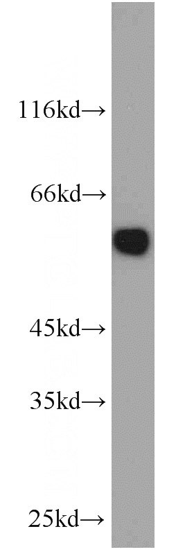 HepG2 cells were subjected to SDS PAGE followed by western blot with Catalog No:114258(PTBP1 antibody) at dilution of 1:1000