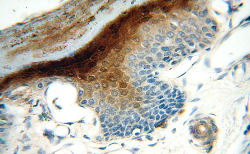 Immunohistochemical of paraffin-embedded human skin using Catalog No:115202(SERPINB13 antibody) at dilution of 1:100 (under 40x lens)