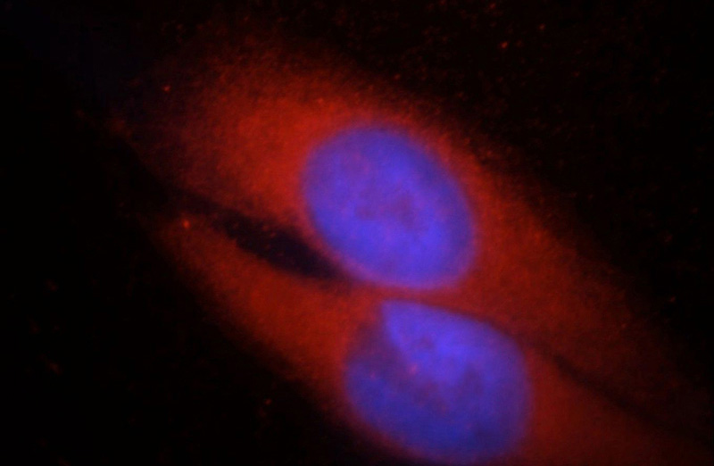 Immunofluorescent analysis of HepG2 cells, using CHAT antibody Catalog No:109209 at 1:25 dilution and Rhodamine-labeled goat anti-rabbit IgG (red). Blue pseudocolor = DAPI (fluorescent DNA dye).