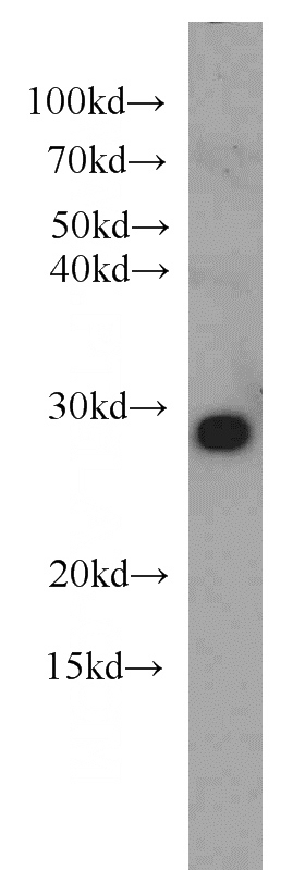 mouse brain tissue were subjected to SDS PAGE followed by western blot with Catalog No:113189(NIPSNAP3A antibody) at dilution of 1:1000
